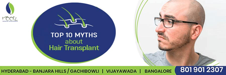 Top 10 myths about Hair Transplantation.jpg